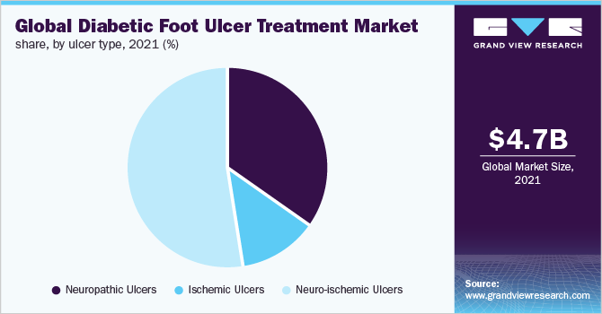 Global diabetic foot ulcer treatment market share, by ulcer type, 2021 (%) 全球糖尿病足溃疡治疗市场份额,按溃疡类型分列,2021年(%)